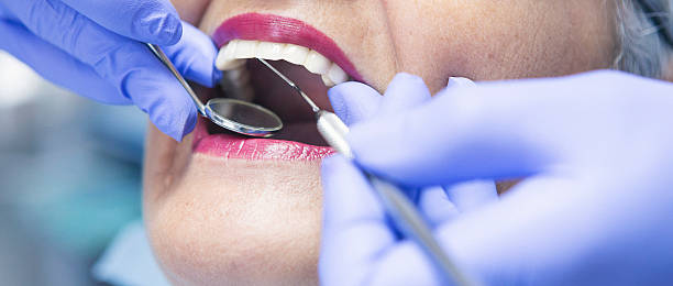 Best Emergency Tooth Extraction in Vienna, IL